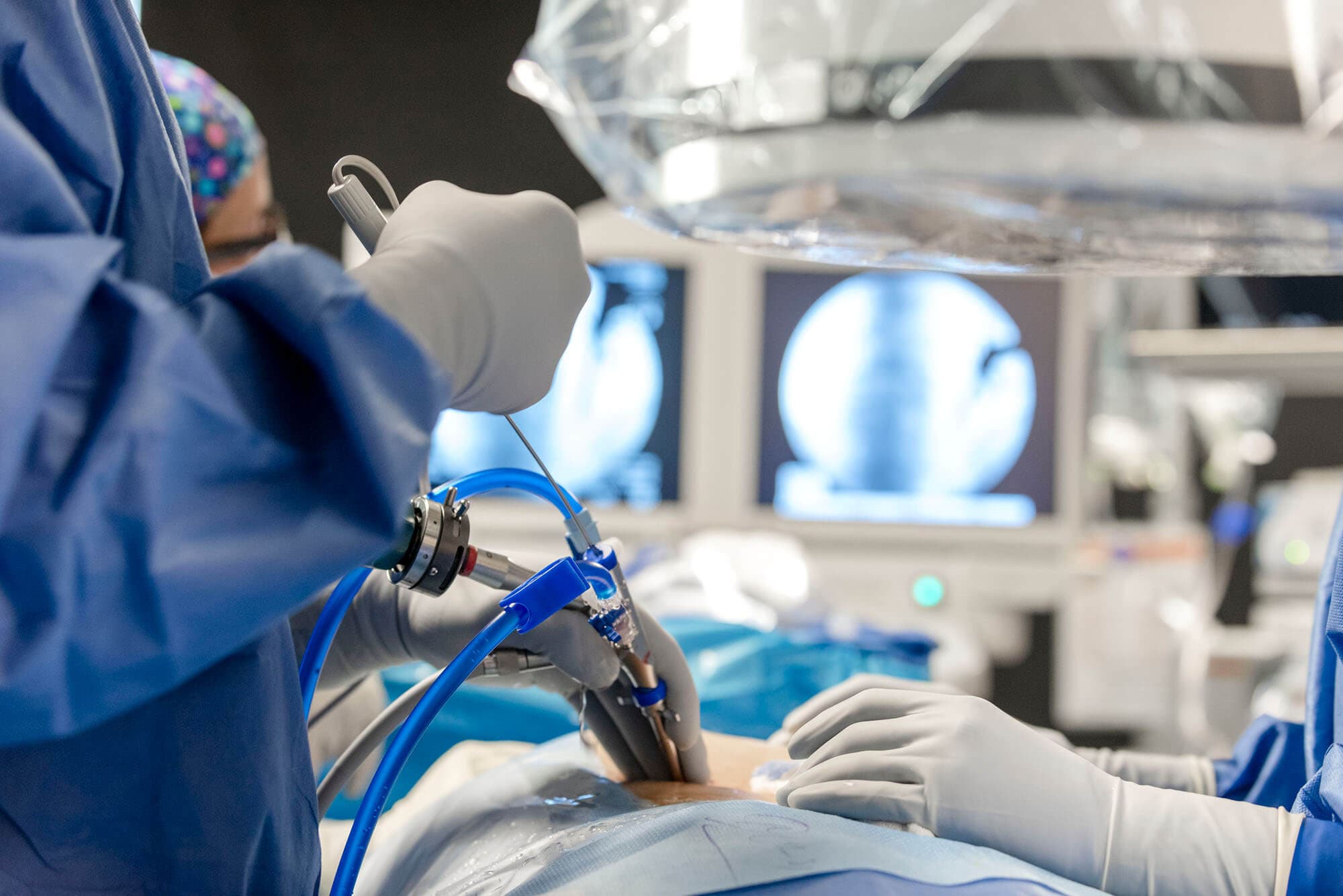 Endoscopy